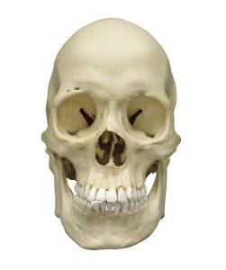 Scaphocephalische Schedel