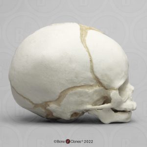 Schedel foetus 32 weken