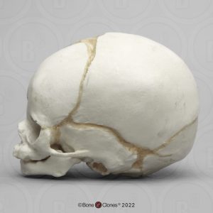 Schedel foetus 32 weken