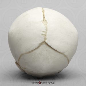 Schedel foetus 32 weken