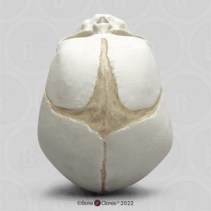 Schedel foetus 32 weken