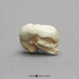 Schedelmodel Foetus 13 weken
