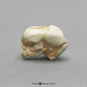 Schedelmodel Foetus 13 weken