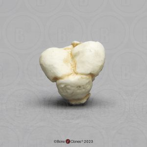 Schedelmodel Foetus 13 weken