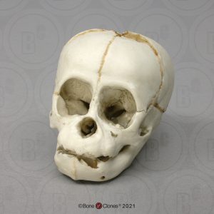 Schedelmodel Foetus Orang-oetan