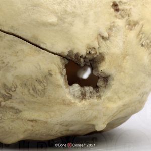 Schedelmodel met Schotwond