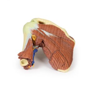 Schouder links, diepe dissectie, 3Dprint