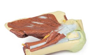 Schouder links, diepe dissectie, 3Dprint