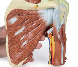 Schouder links, diepe dissectie, 3Dprint