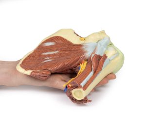 Schouder links, diepe dissectie, 3Dprint