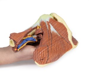 Schouder links, diepe dissectie, 3Dprint