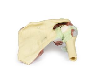 Schouder rechts, diepe dissectie, 3D Print