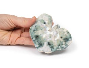 Septisch Nierinfarct, 3D Print