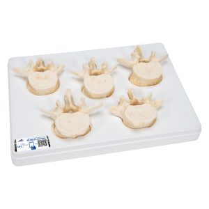 set van 5 losse Lumbale wervels, BONElike
