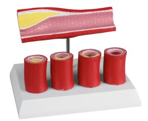 Slagader Model
