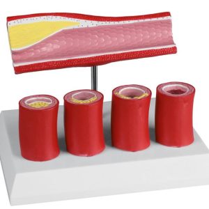 Slagader Model