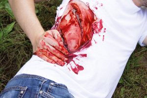 Snee Wond Model met Bloedingsfunctie
