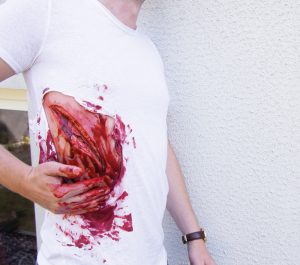 Snee Wond Model met Bloedingsfunctie