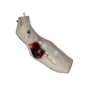 Standaard Arm voor Chester Chest