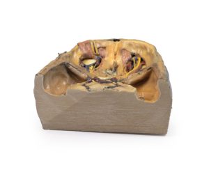 Superieure Oogkas, 3D Print