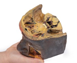 Superieure Oogkas, 3D Print