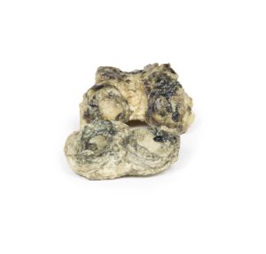 Suppuratieve Artritis in de Knie, 3D Print