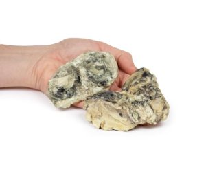 Suppuratieve Artritis in de Knie, 3D Print