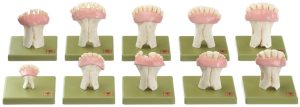 Tanden Model Set Koe