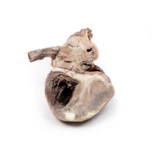 Tetralogie van Fallot, 3D Print