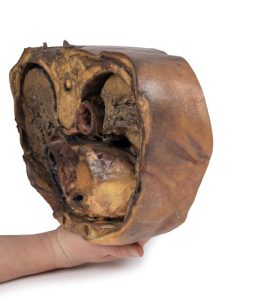 Thoracale Doorsnede T6, 3D Print