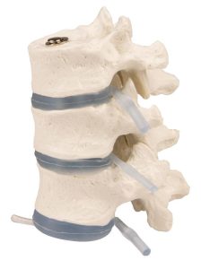 Borstwervels Model