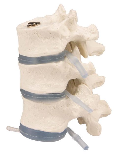 Borstwervels Model