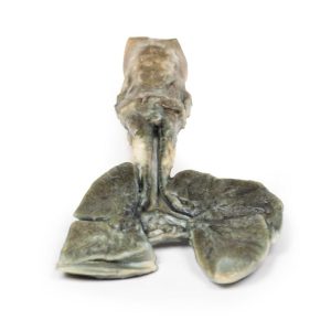 Tracheoesofageale Fistel en Oesofagusatresie, 3D Print
