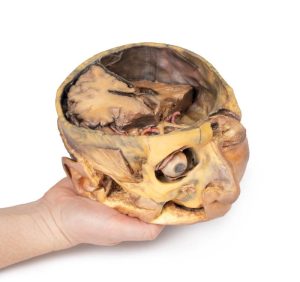 Transversale Doorsnede Hoofd, 3D Print