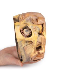 Transversale Doorsnede Hoofd, 3D Print