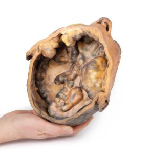 Transversale Doorsnede Hoofd, 3D Print