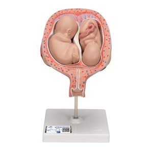 Tweeling foetus model maand 5