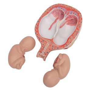 Tweeling foetus model maand 5