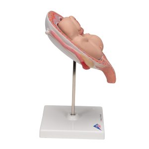 Tweeling foetus model maand 5