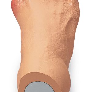 Uitgebreid Voetproblemen Model