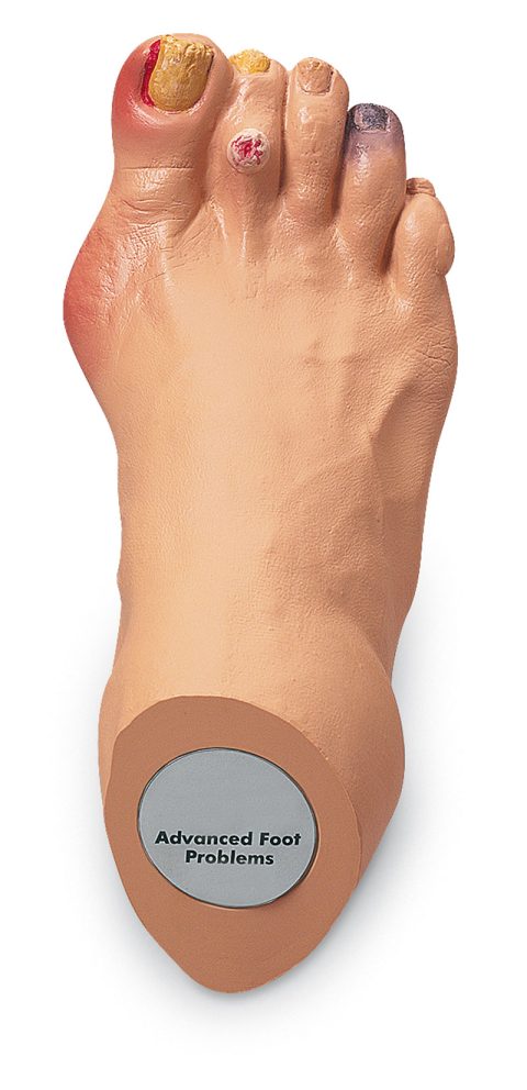Uitgebreid Voetproblemen Model