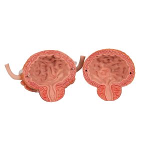 Urinair systeem, 2-slachtig, 6-delig