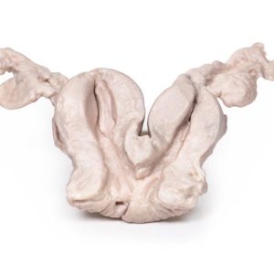 Uterus Bicornis Unicollis, 3D Print