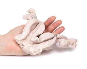 Uterus Bicornis Unicollis, 3D Print