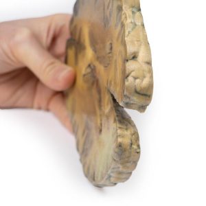 Ventriculitis, secundair aan bloedvergiftiging, 3D Print