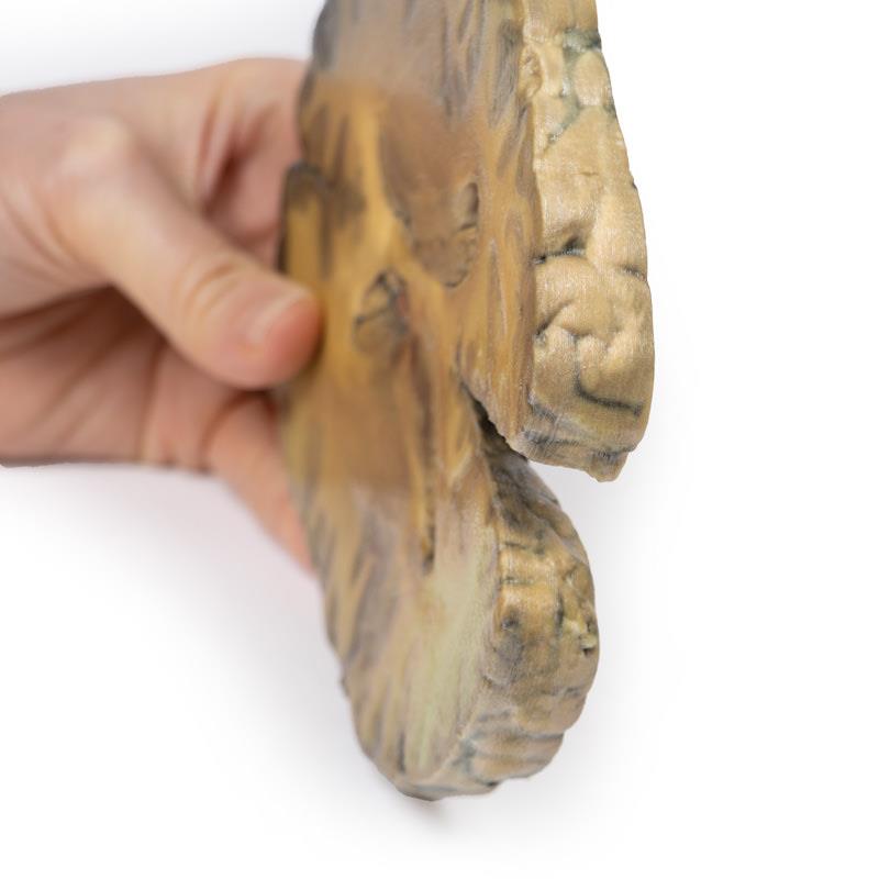 Ventriculitis, secundair aan bloedvergiftiging, 3D Print