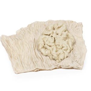 Villeus Adenoom in Dikke Darm, 3D Print