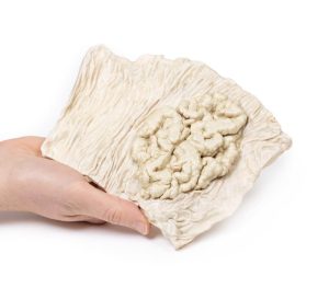 Villeus Adenoom in Dikke Darm, 3D Print