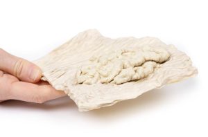 Villeus Adenoom in Dikke Darm, 3D Print