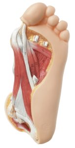 Voet met Hallux valgus